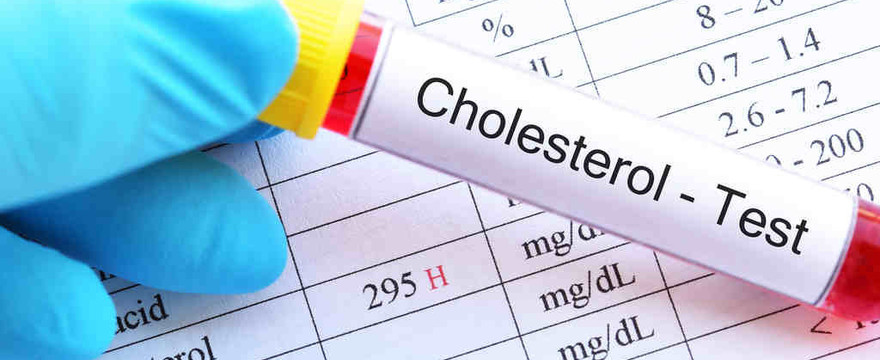 Czy zbyt niski poziom cholesterolu może być niebezpieczny dla zdrowia?